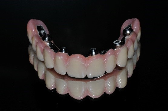 Implant Systems 2