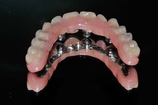 Implant Systems 1